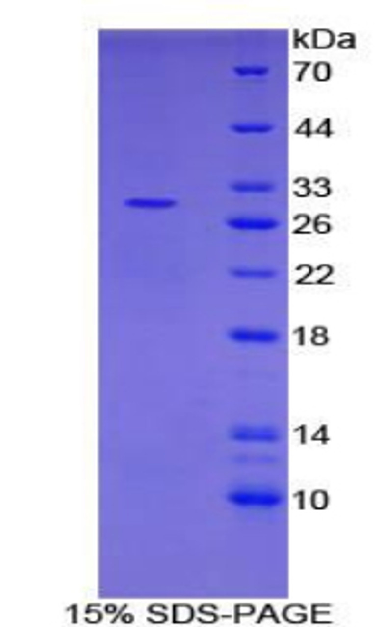 Human Recombinant Protein Inhibitor Of Activated STAT 1 (PIAS1)