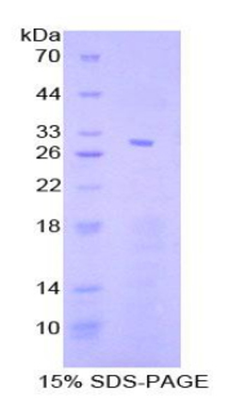Human Recombinant Signal Transducer And Activator Of Transcription 4 (STAT4)
