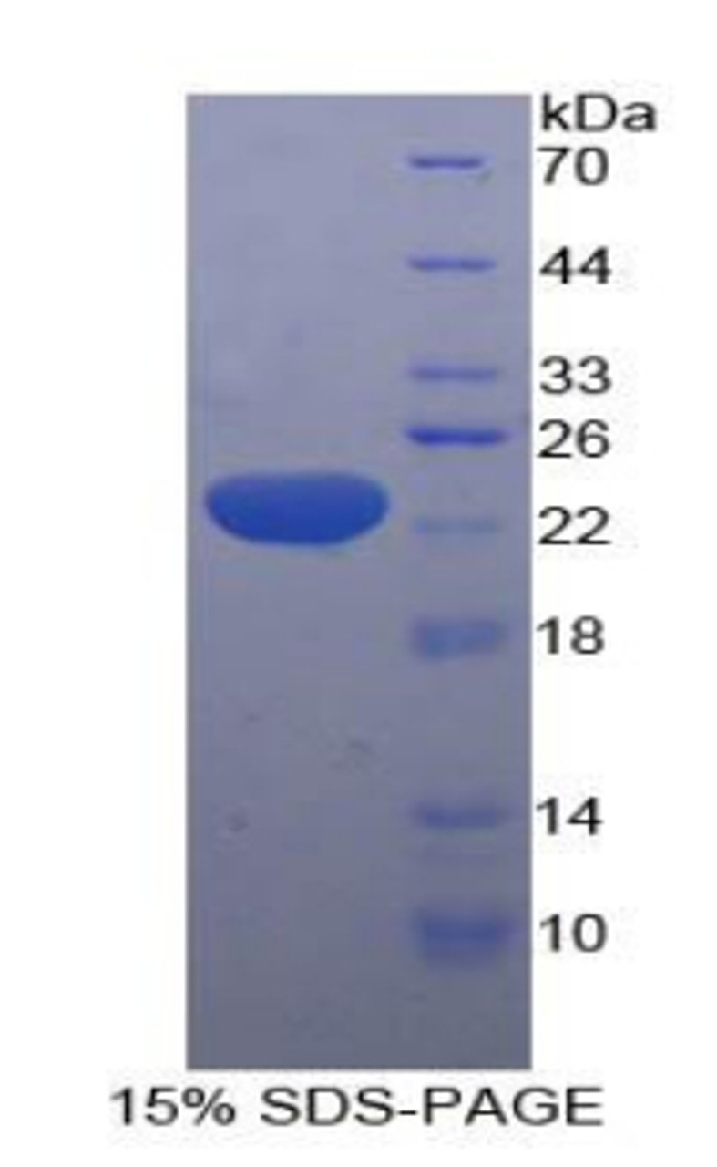 Human Recombinant Hydroxymethylglutaryl Coenzyme A Synthase (HMGCS)