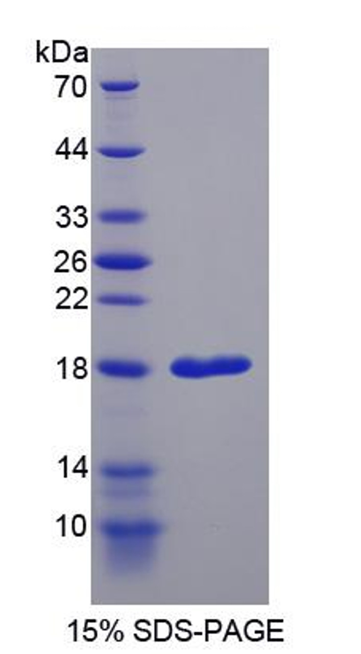 Rat Recombinant Regenerating Islet Derived Protein 1 Alpha (REG1a)