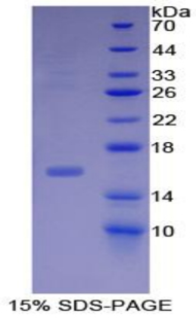 Human Recombinant Inhibin Beta B (INHbB)