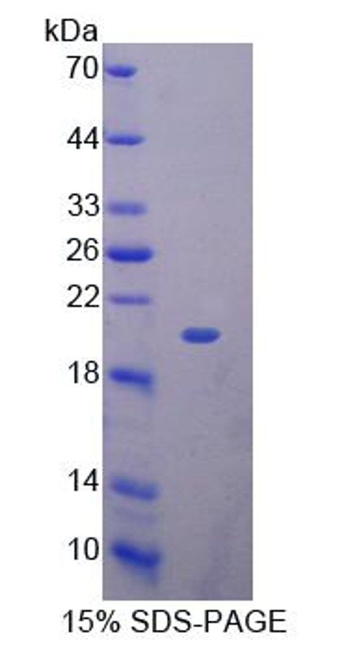 Mouse Recombinant Killer Cell Lectin Like Receptor Subfamily K, Member 1 (KLRK1)