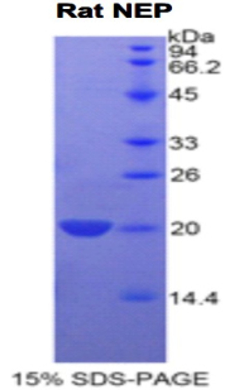 Rat Recombinant Neprilysin (NEP)