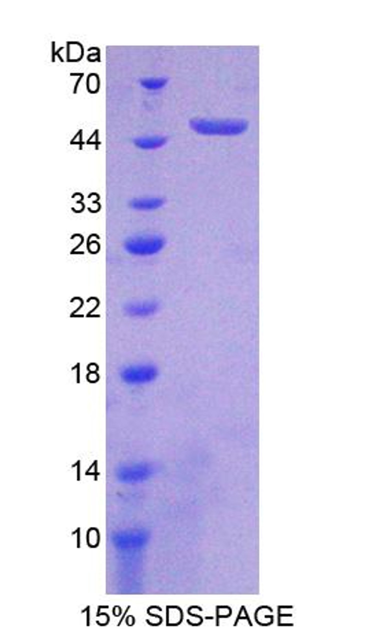 Rat Recombinant Fibroblast Growth Factor Receptor 1 (FGFR1)