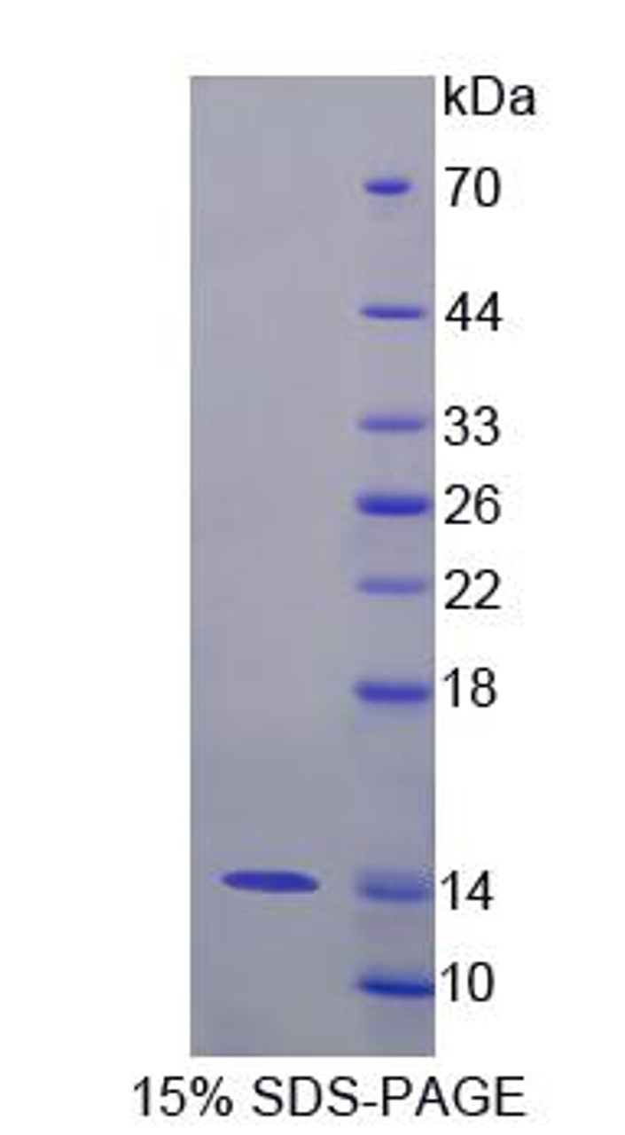 Rabbit Recombinant S100 Calcium Binding Protein A8 (S100A8)