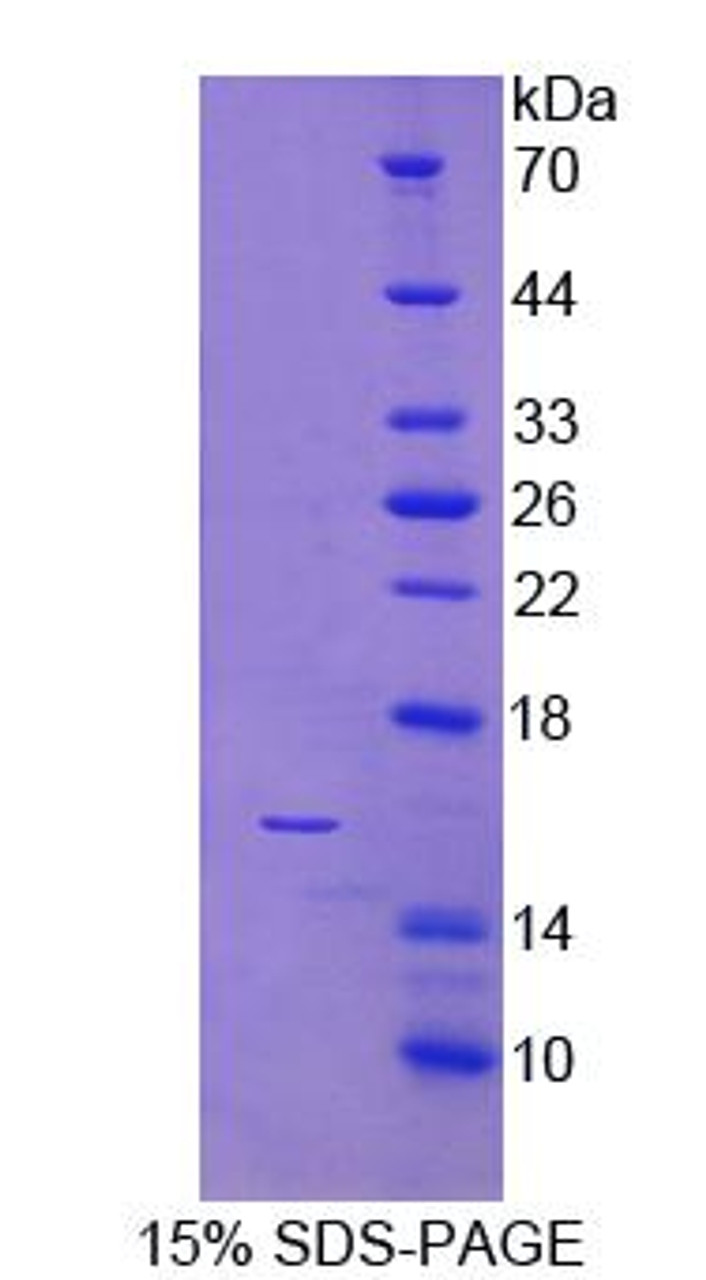 Human Recombinant Natural Cytotoxicity Triggering Receptor 3 (NCR3)