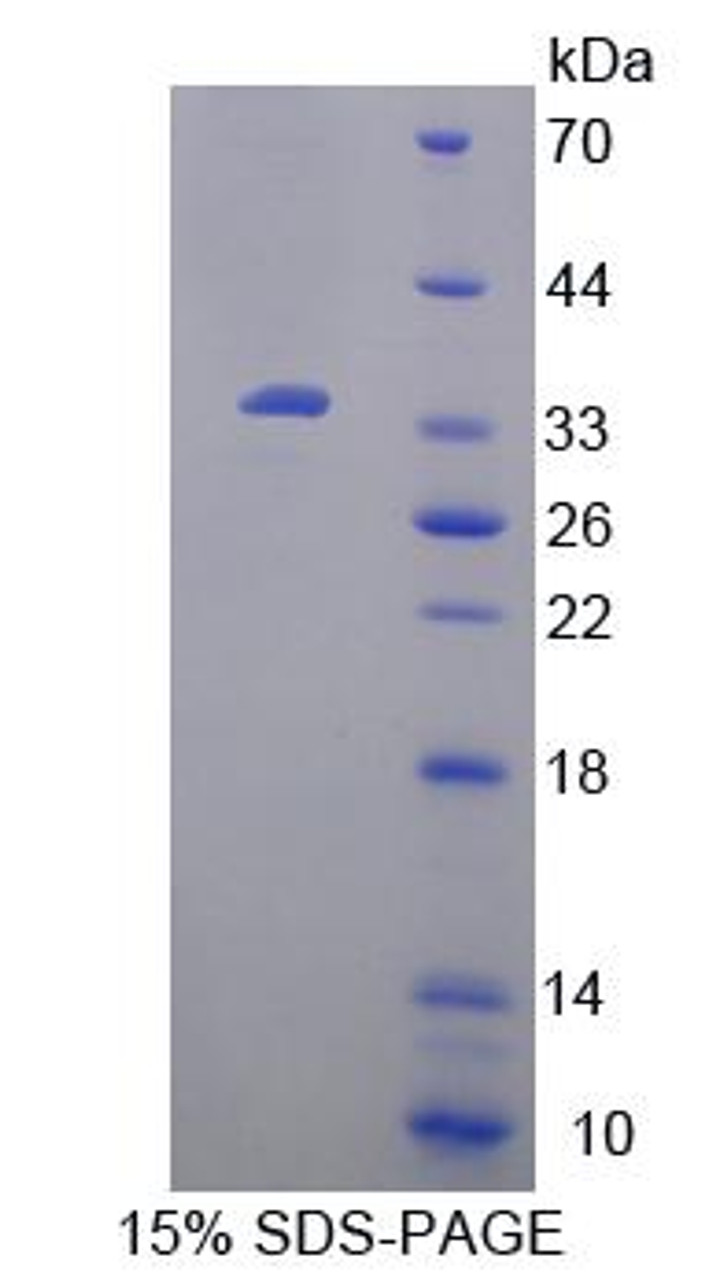 Mouse Recombinant Uridine Phosphorylase 1 (UPP1)