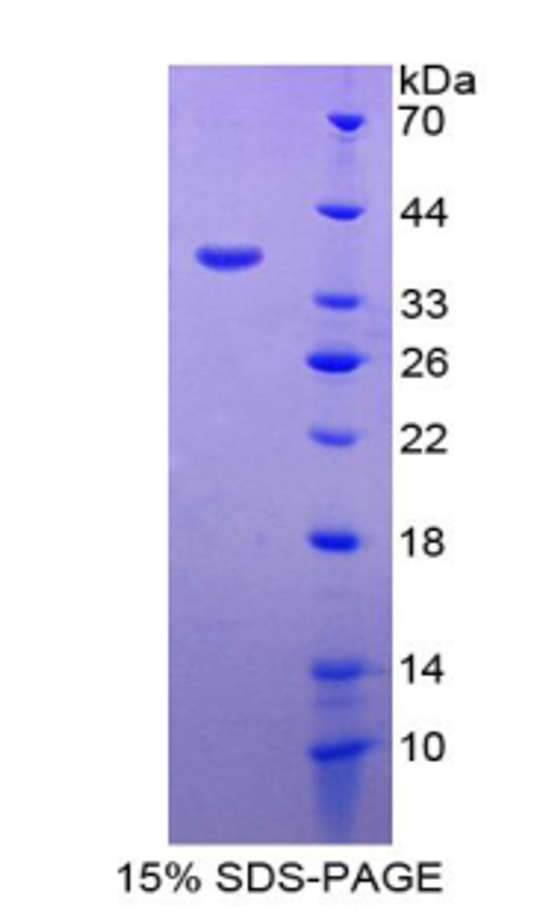 Rat Recombinant Interleukin 6 Receptor (IL6R)