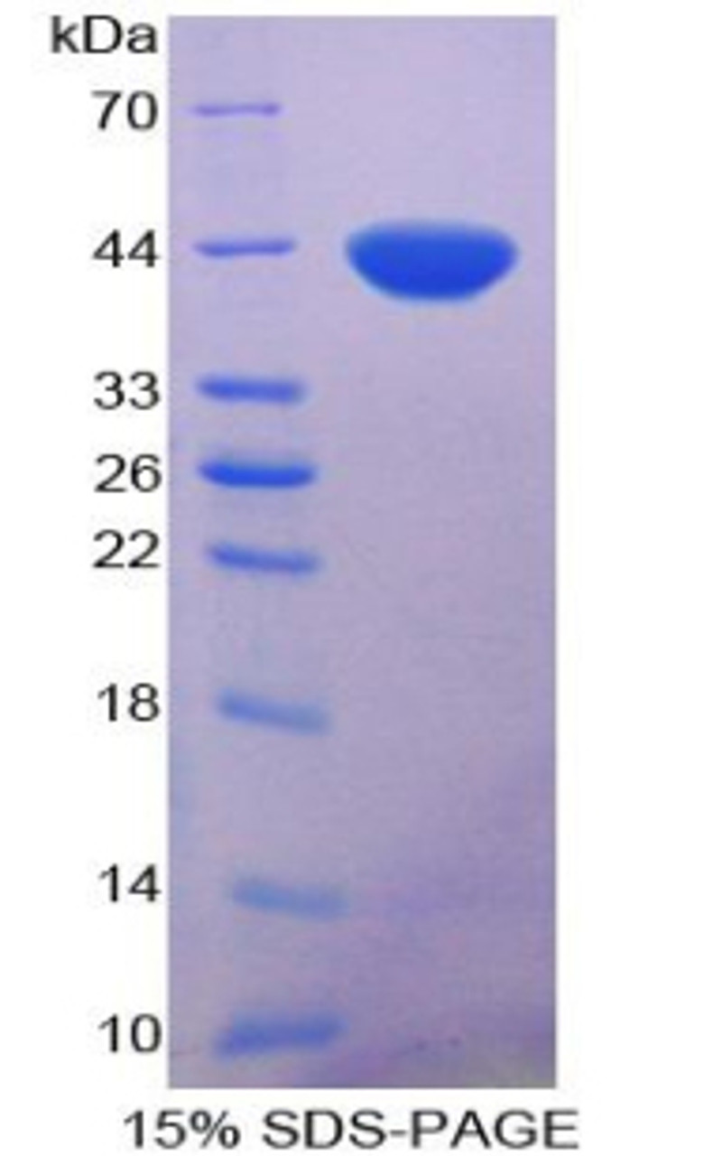 Human Recombinant Nuclear Factor Kappa B (NFkB)