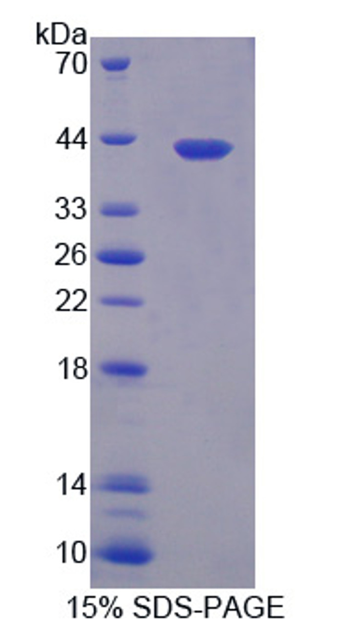 Rat Recombinant Nuclear Factor Kappa B (NFkB)