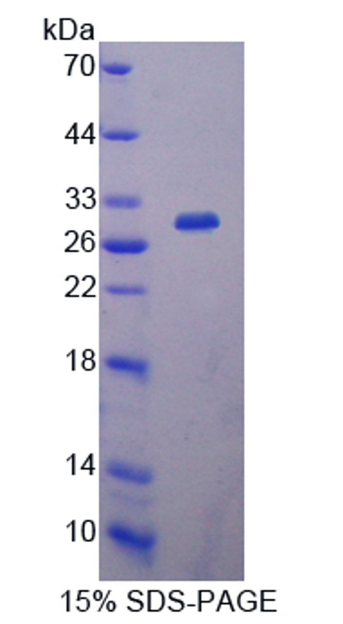 Pig Recombinant Interleukin 2 Receptor Alpha (IL2Ra)