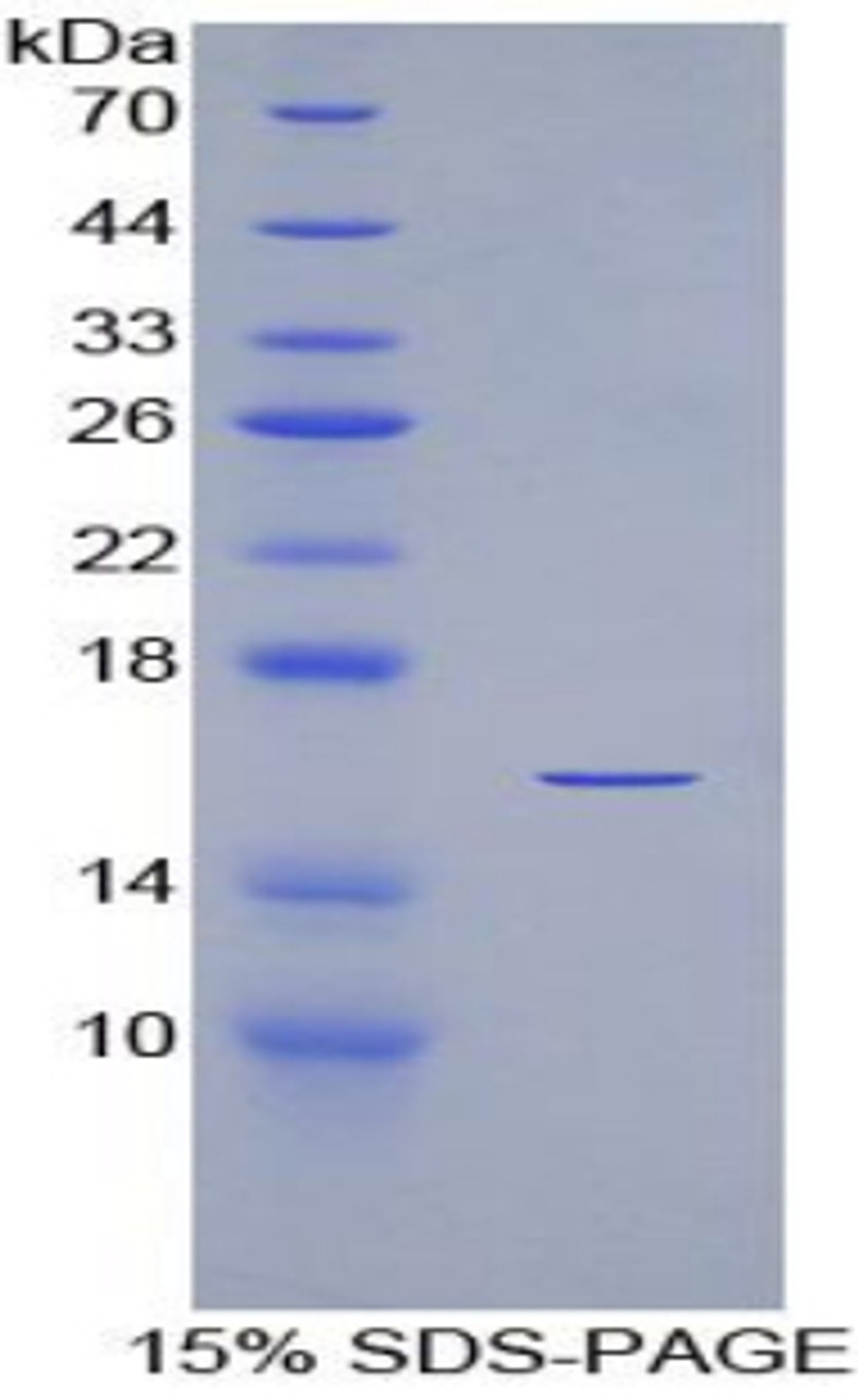 Human Recombinant Vascular Endothelial Growth Factor 121 (VEGF121)