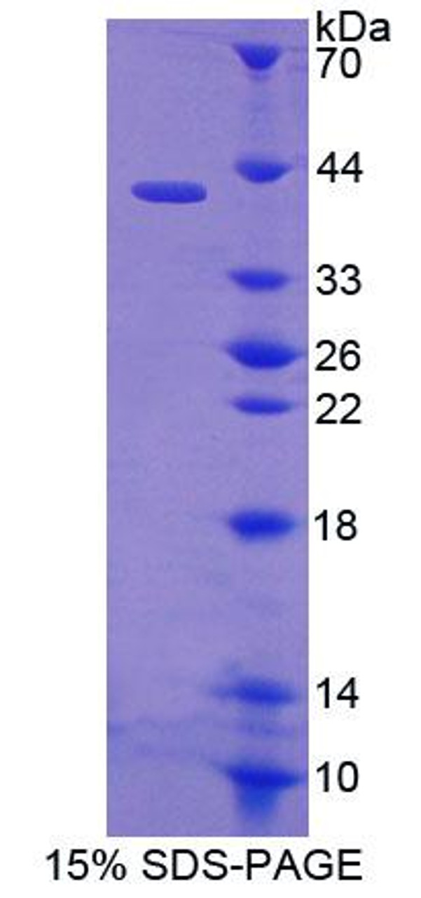 Human Recombinant Epidermal Growth Factor Receptor 2 (EGFR2)