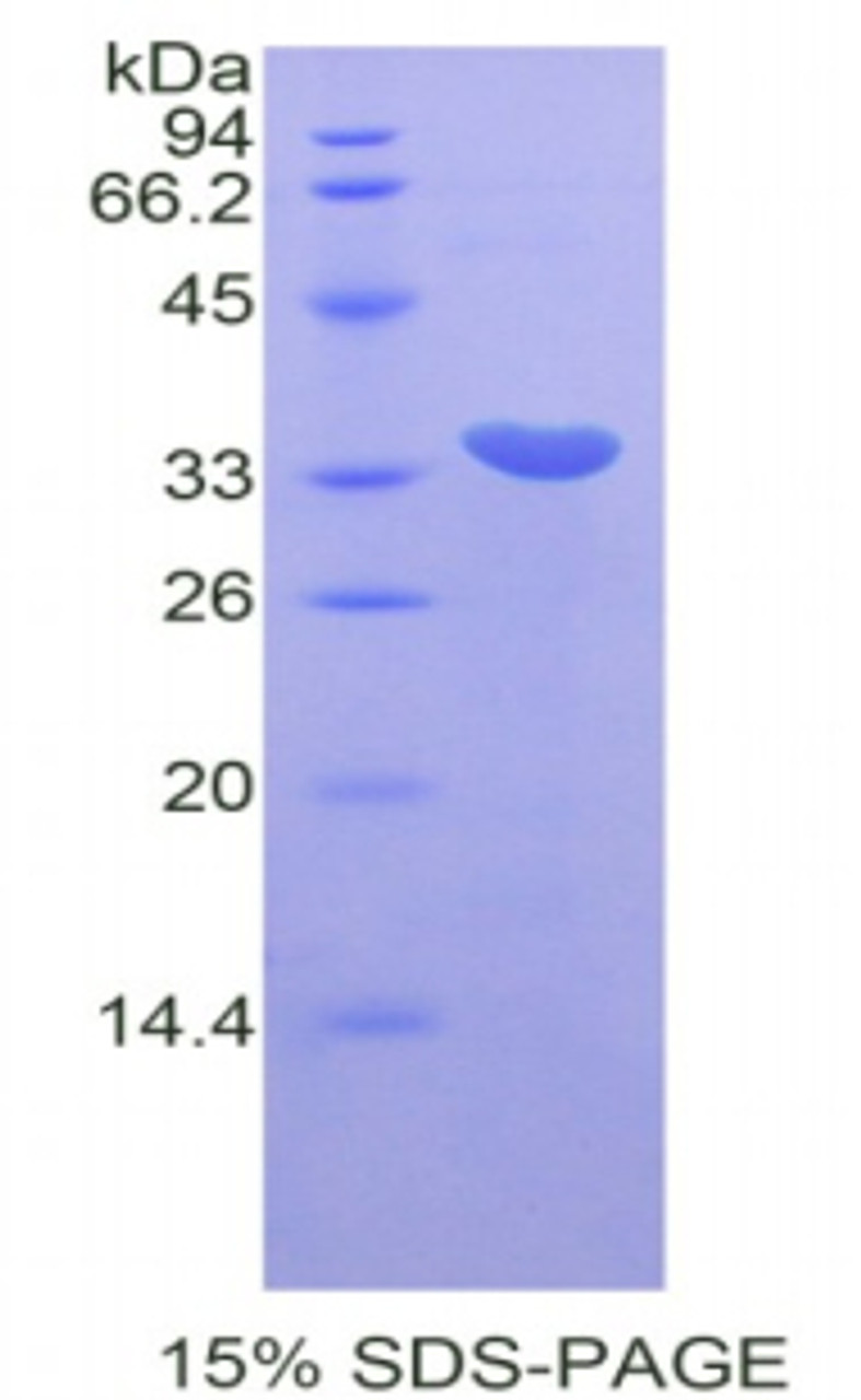 Mouse Recombinant Cyclin Dependent Kinase 7 (CDK7)