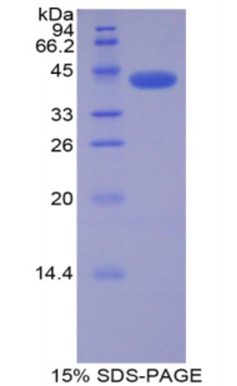 Rat Recombinant Cyclin Dependent Kinase 2 (CDK2)