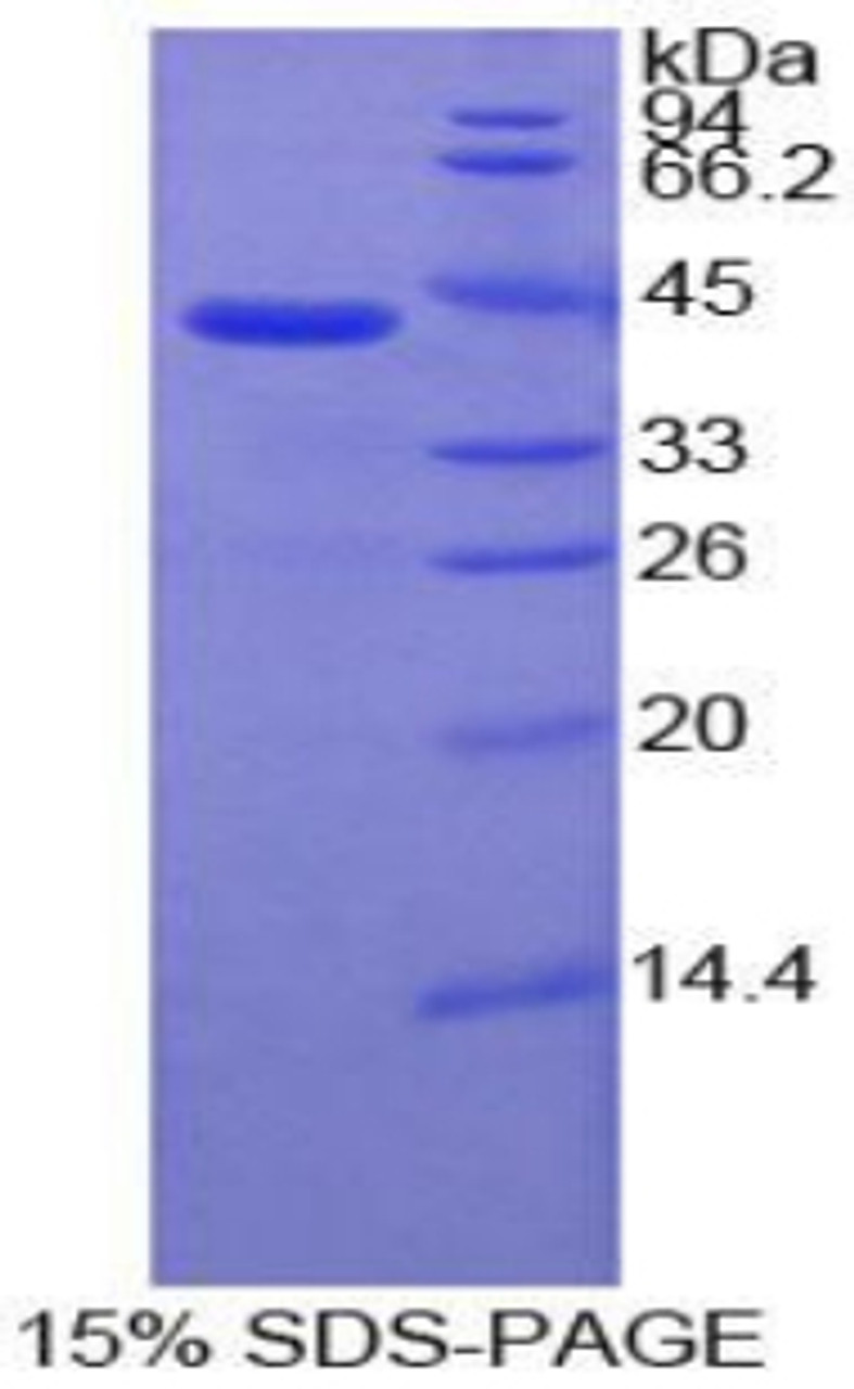 Human Recombinant Interleukin 7 Receptor (IL7R)