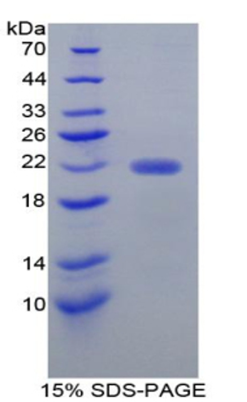 Mouse Recombinant Ficolin 2 (FCN2)