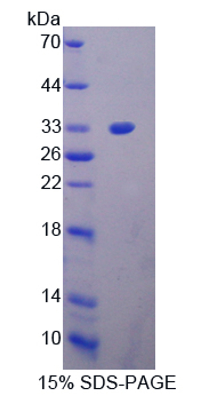 Cattle Recombinant Aggrecan (AGC)