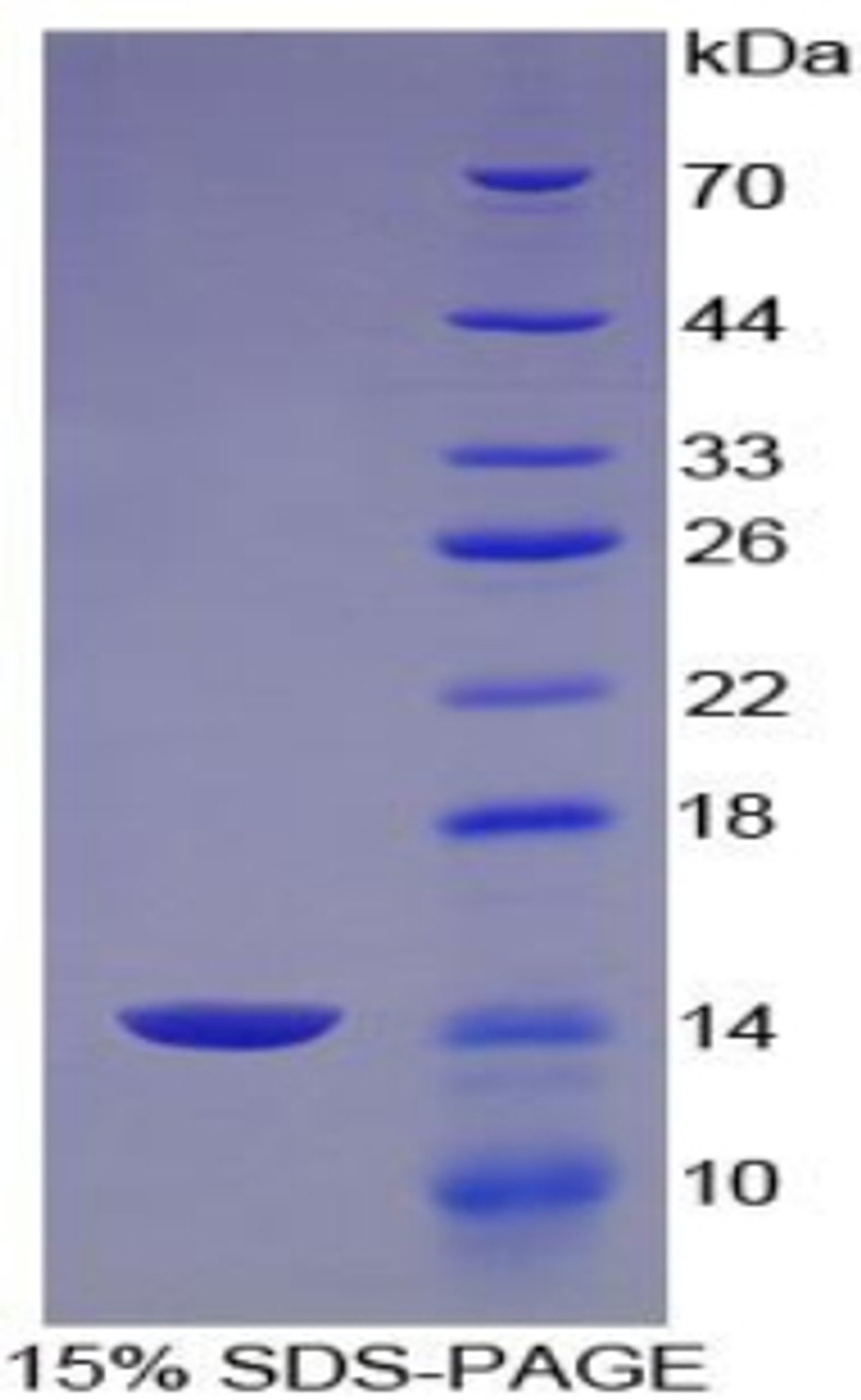 Mouse Recombinant Aggrecan (AGC)