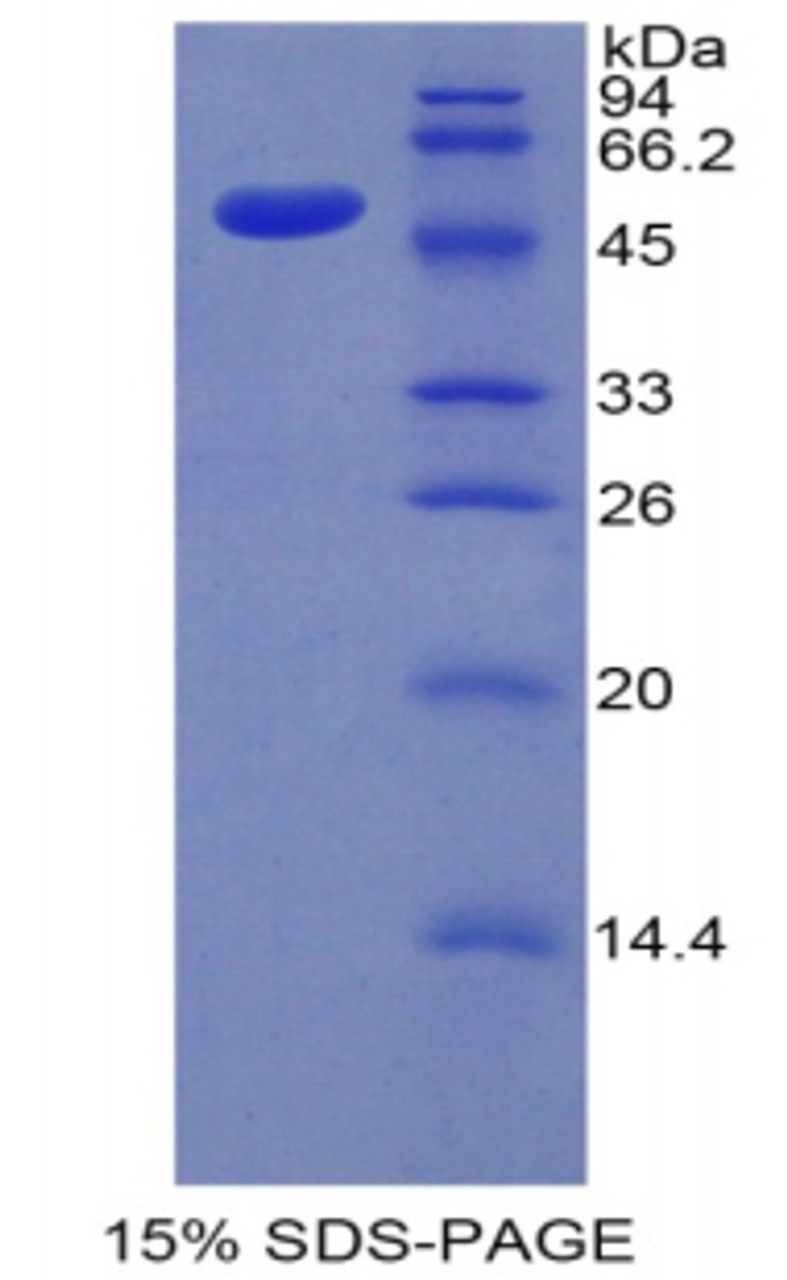 Mouse Recombinant Kallikrein 7 (KLK7)