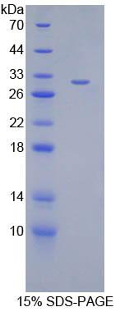 Mouse Recombinant Angiopoietin Like Protein 2 (ANGPTL2)