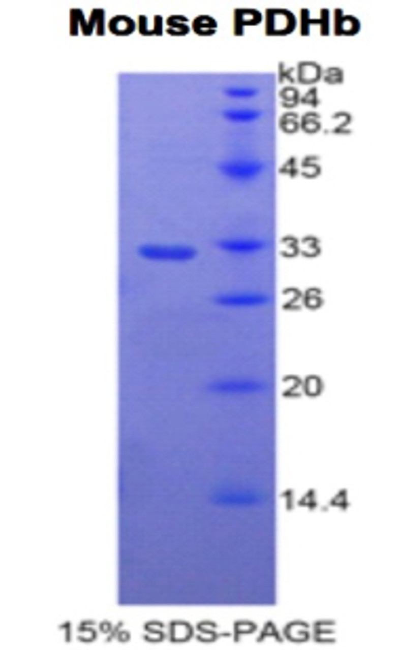 Mouse Recombinant Pyruvate Dehydrogenase Beta (PDHb)