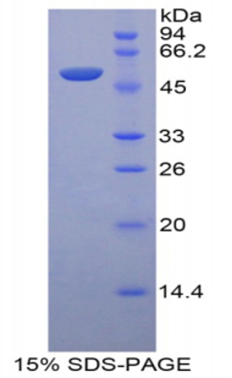 Mouse Recombinant Leucine Rich Alpha-2-Glycoprotein 1 (LRG1)