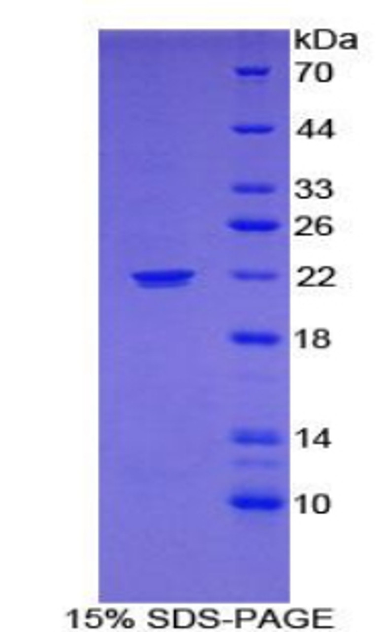 Mouse Recombinant Monoamine Oxidase A (MAOA)