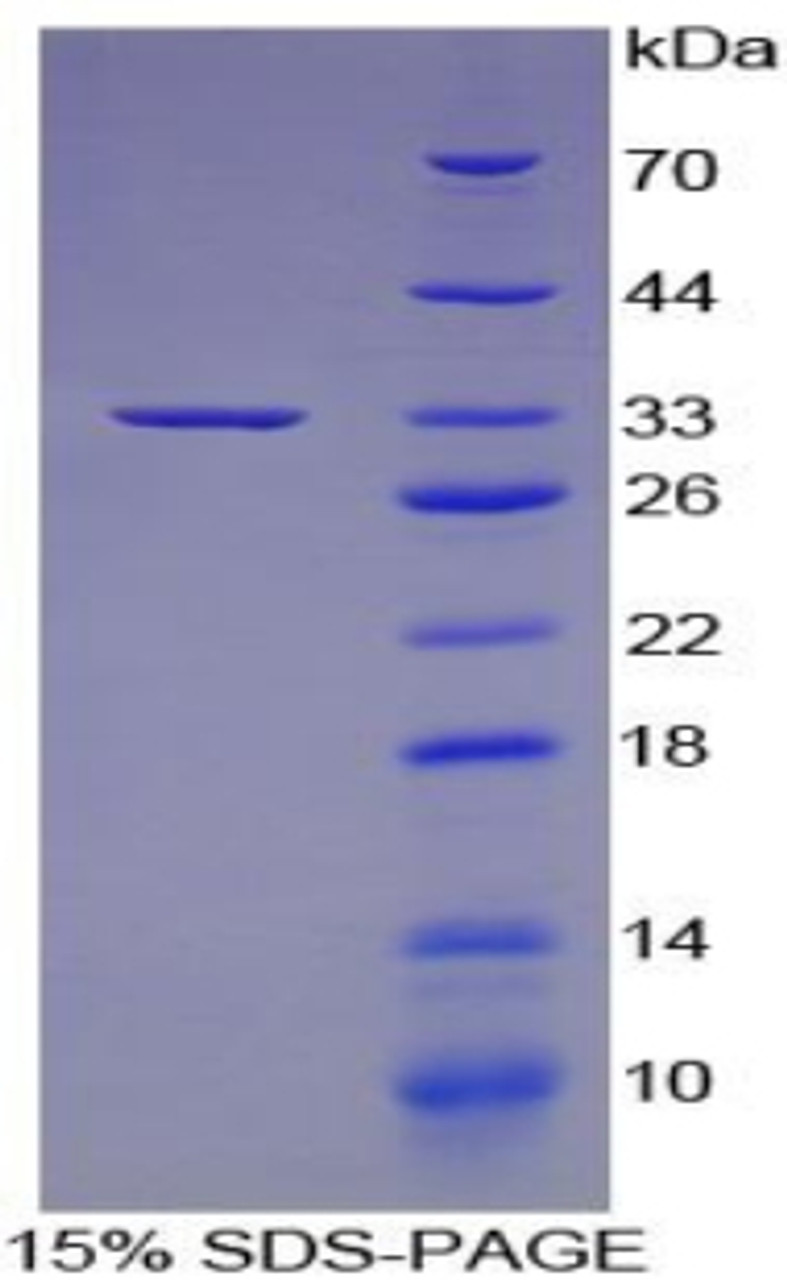 Human Recombinant Interferon Regulatory Factor 6 (IRF6)