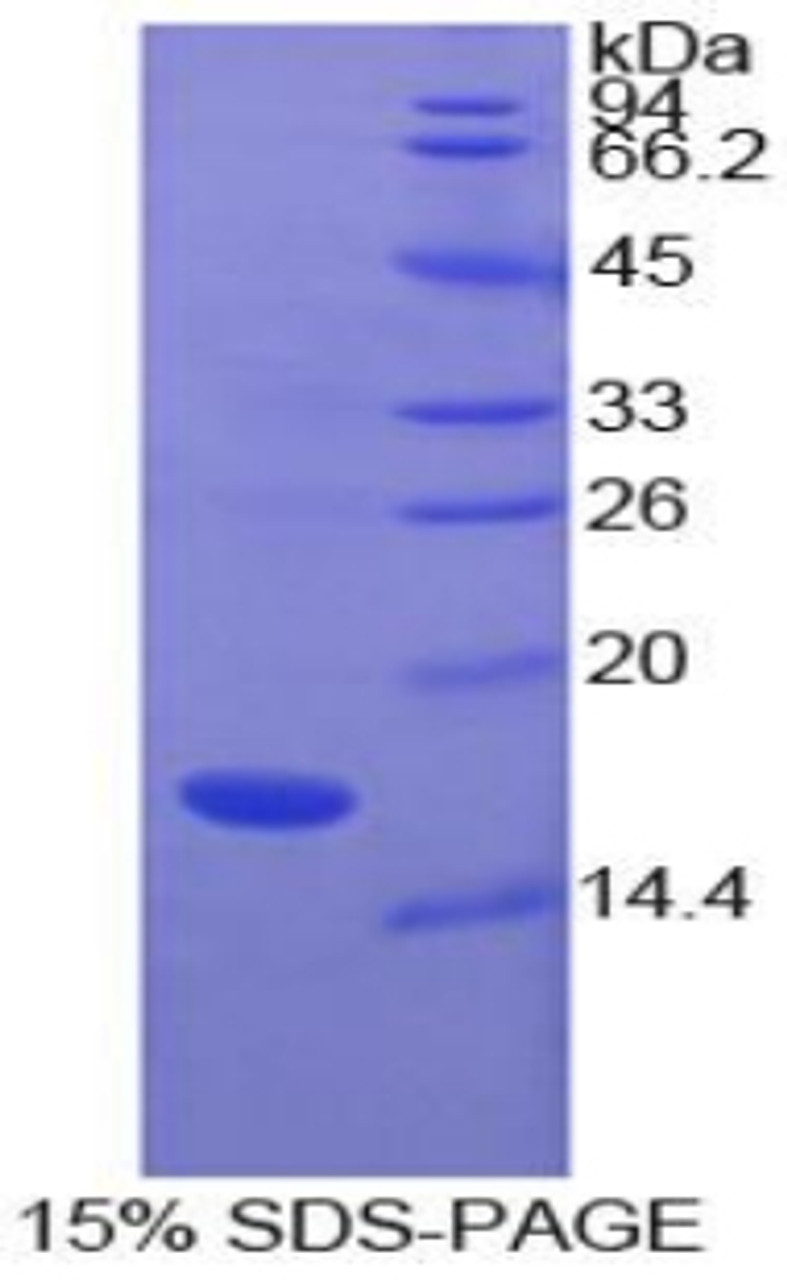 Cattle Recombinant Superoxide Dismutase 1, Soluble (SOD1)