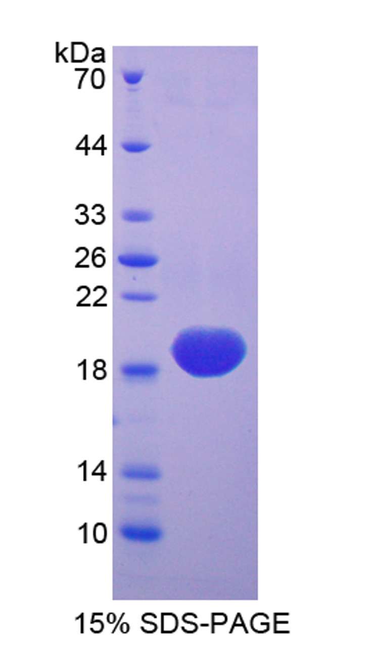 Chicken Recombinant Superoxide Dismutase 1, Soluble (SOD1)