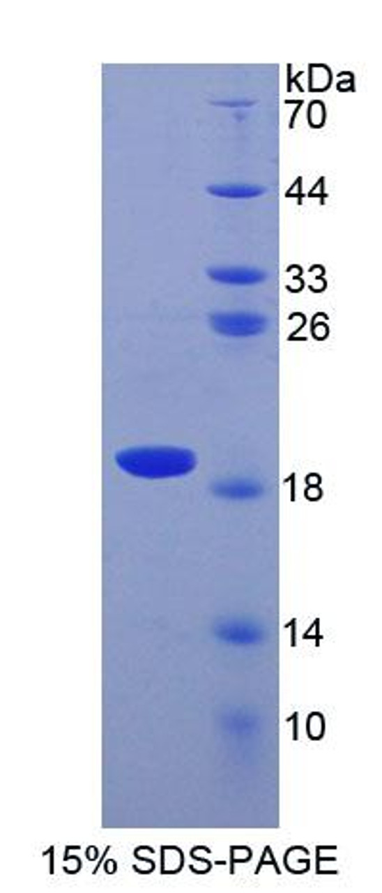 Human Recombinant Superoxide Dismutase 1, Soluble (SOD1)