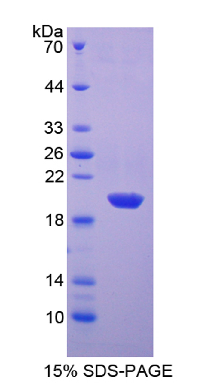 Sheep Recombinant Superoxide Dismutase 1, Soluble (SOD1)