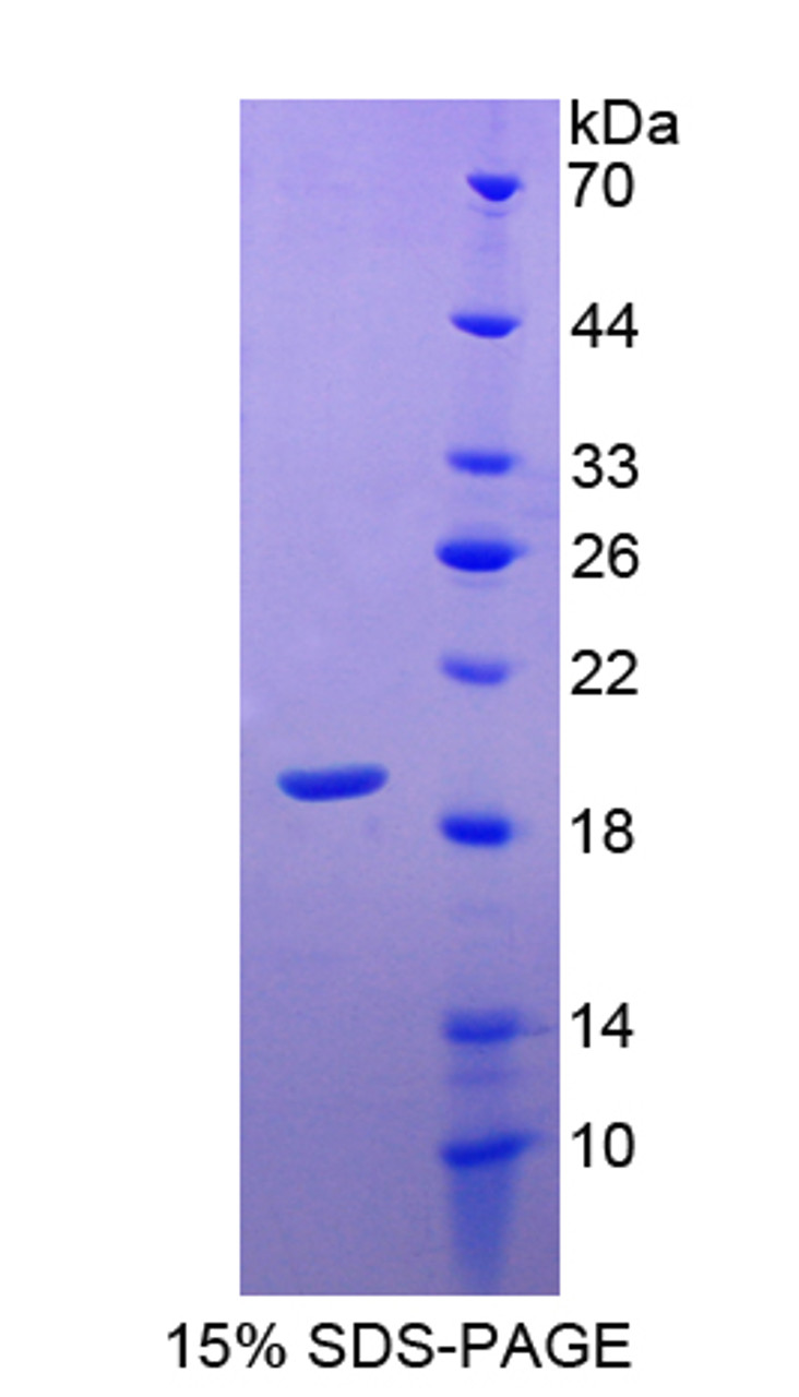 Pig Recombinant Superoxide Dismutase 1, Soluble (SOD1)