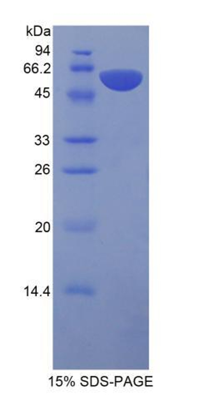 Rat Recombinant Protein S (PROS)