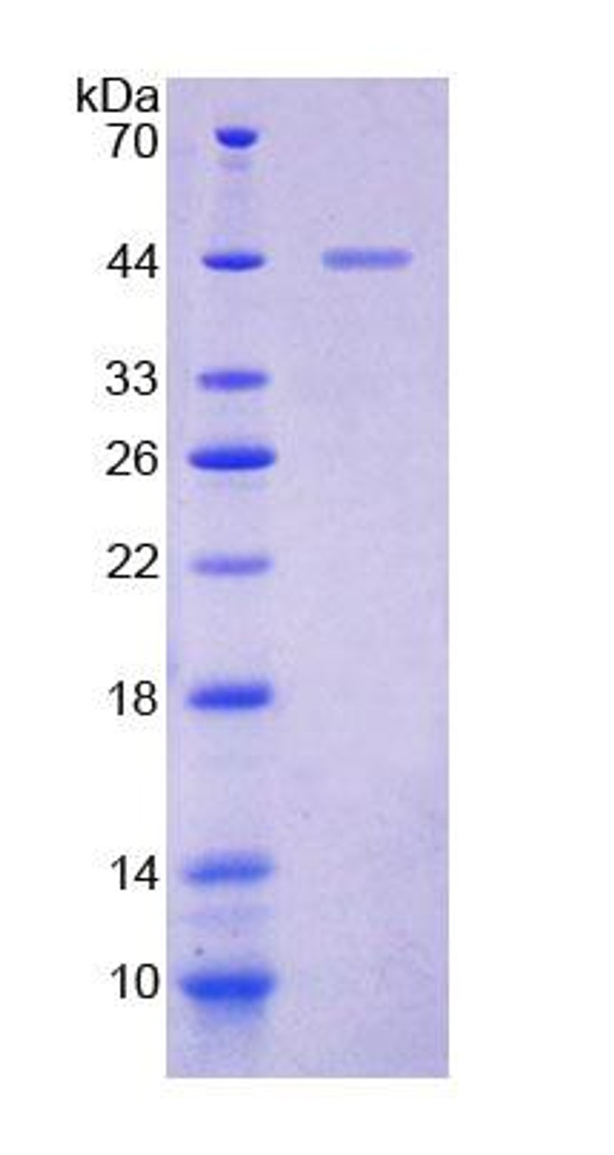 Human Recombinant Tyrosine Kinase Activator Protein 1 (TKA1)