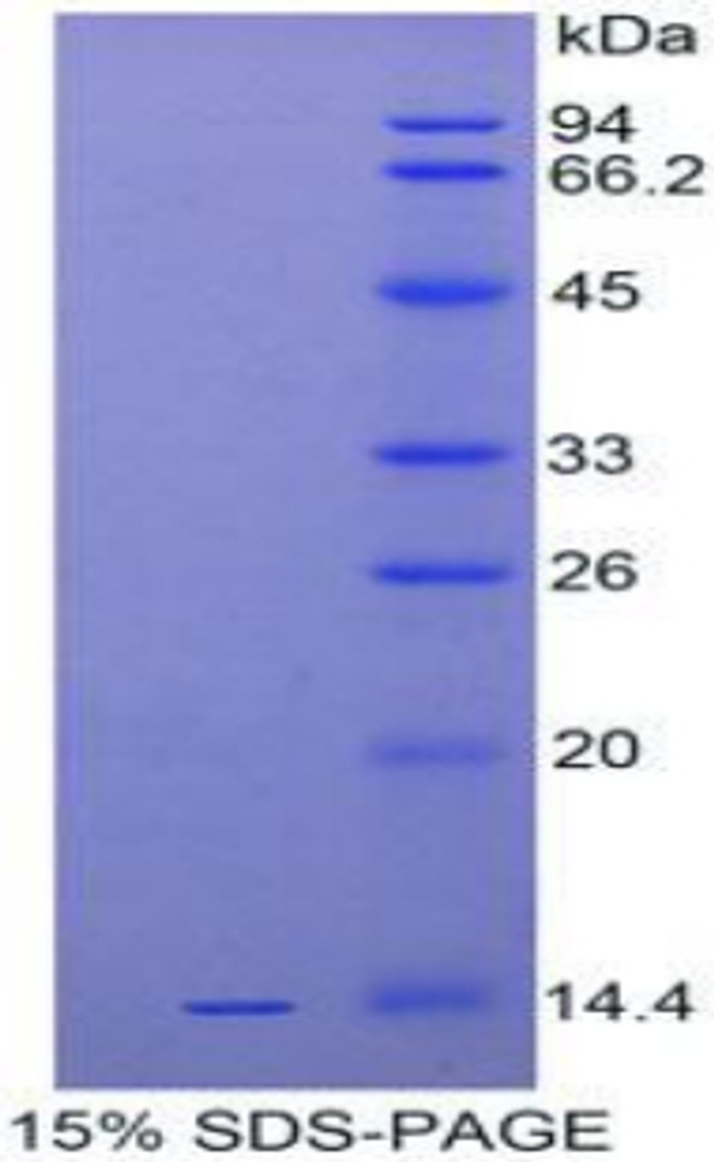 Human Recombinant Interleukin 33 (IL33)