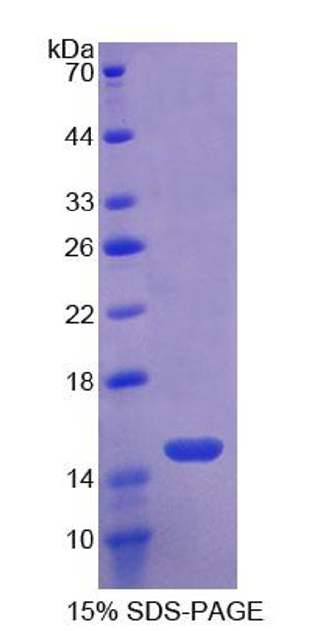 Mouse Recombinant Toll Like Receptor 3 (TLR3)