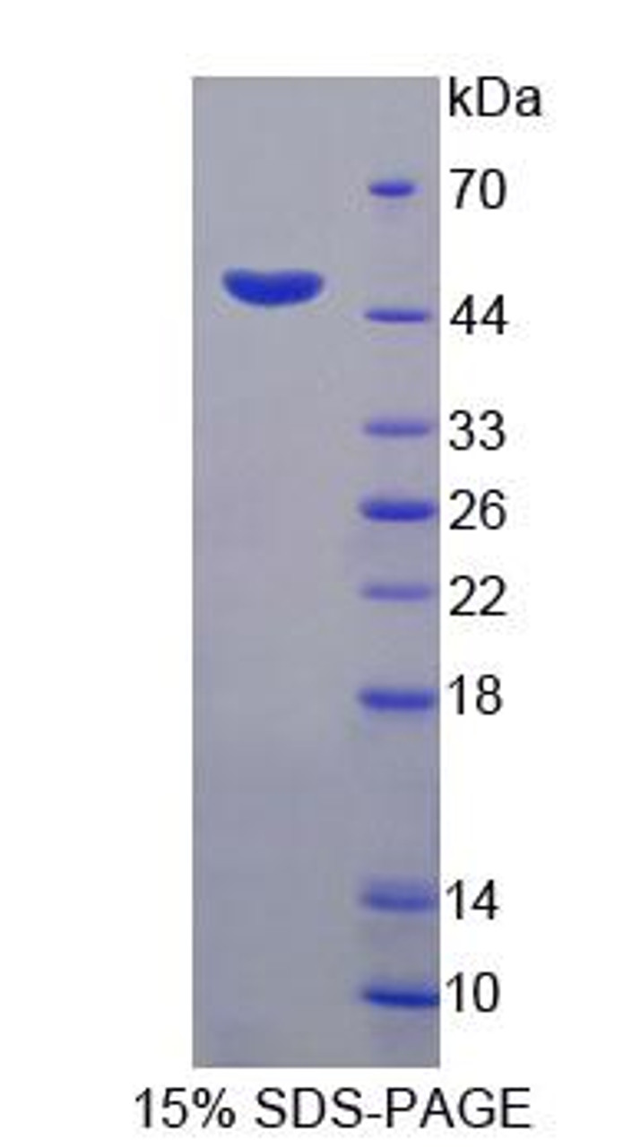 Human Recombinant Hemojuvelin (HJV)