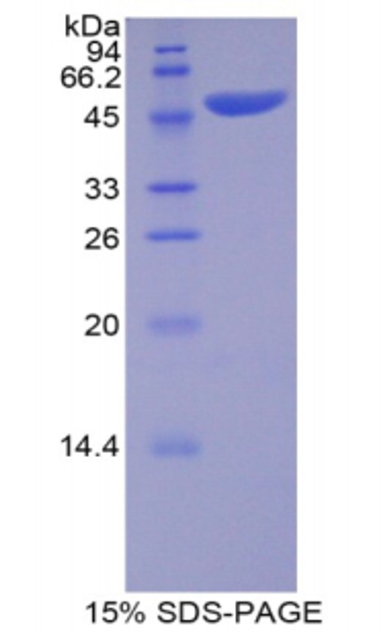 Pig Recombinant Apolipoprotein B (APOB)