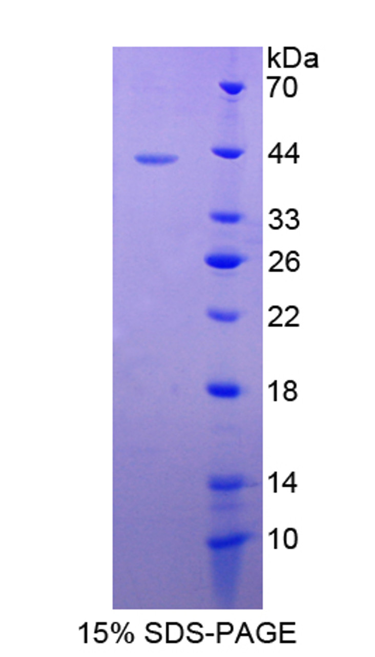 Cattle Recombinant S100 Calcium Binding Protein A2 (S100A2)