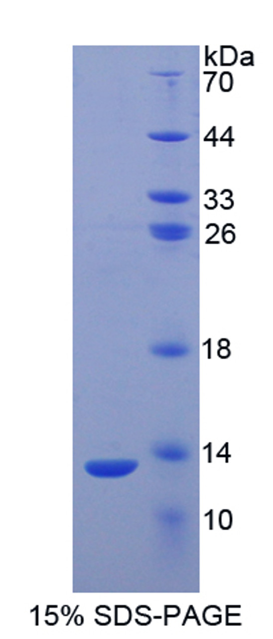 Human Recombinant S100 Calcium Binding Protein A2 (S100A2)