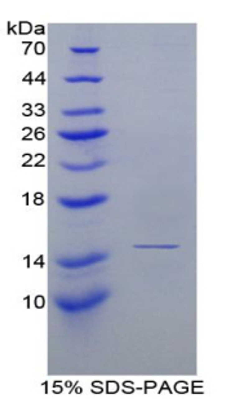 Rat Recombinant Complement Factor B (CFB)