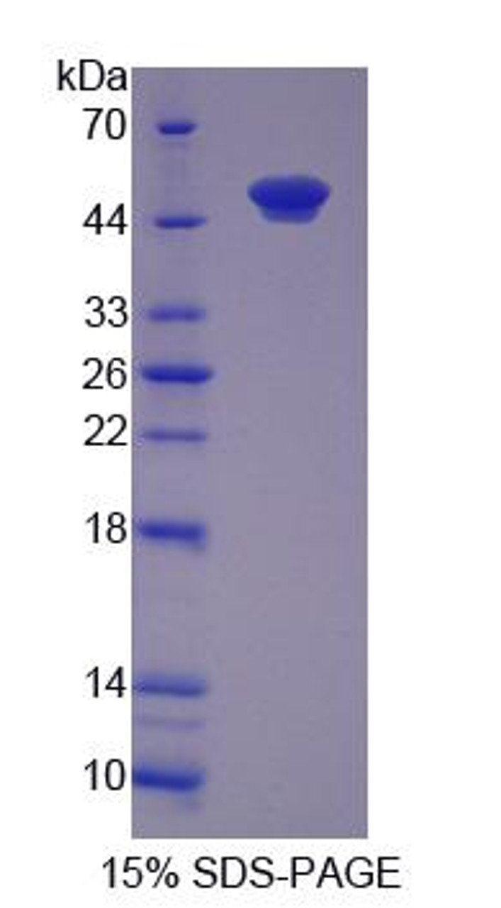 Rat Recombinant O-6-Methylguanine DNA Methyltransferase (MGMT)