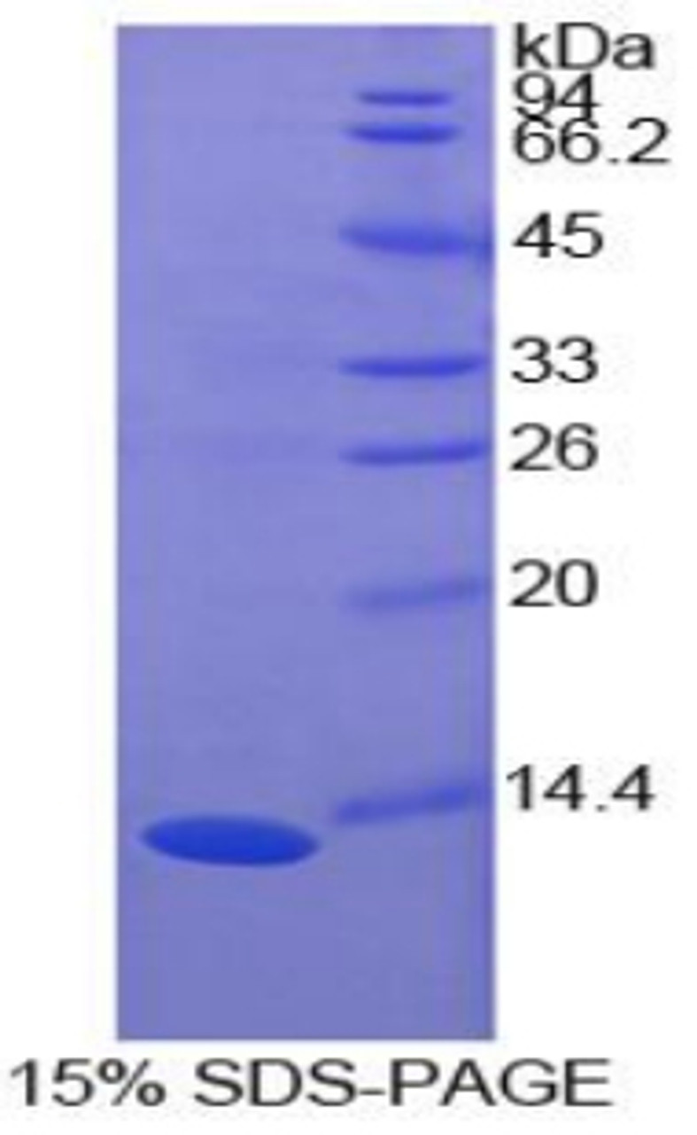 Cattle Recombinant S100 Calcium Binding Protein A10 (S100A10)