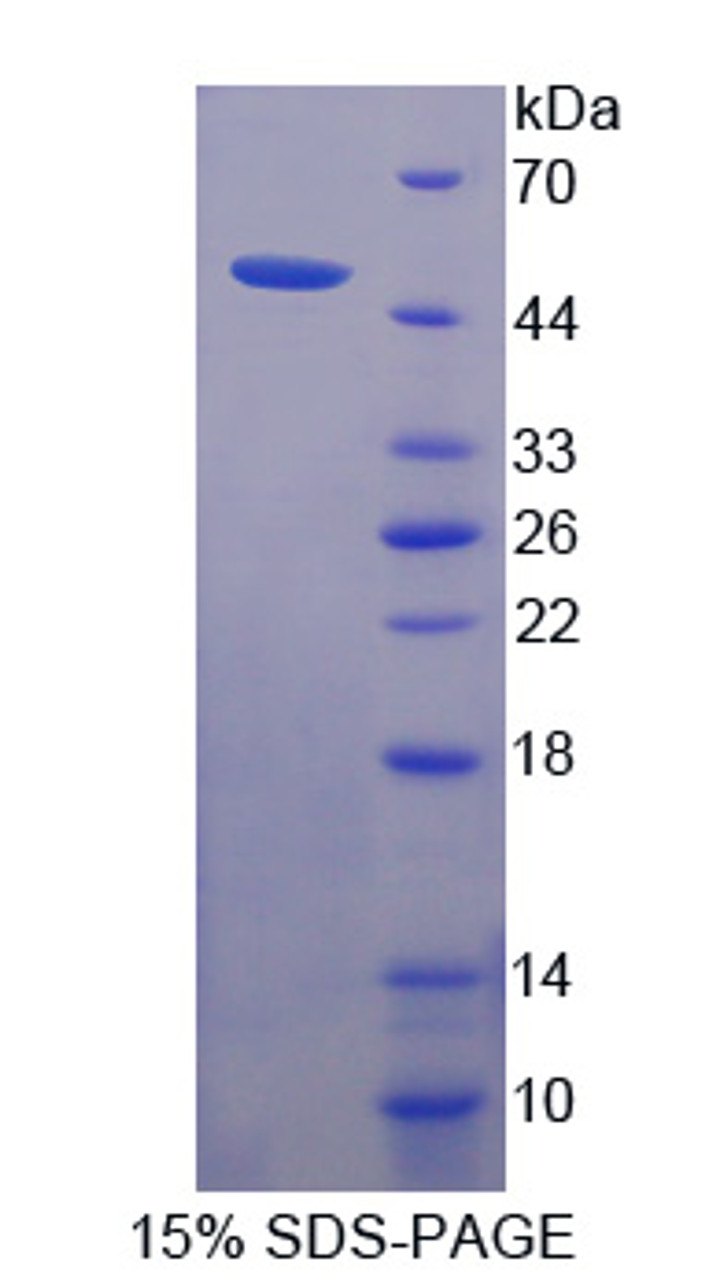 Human Recombinant Phospholipase B (PLB)