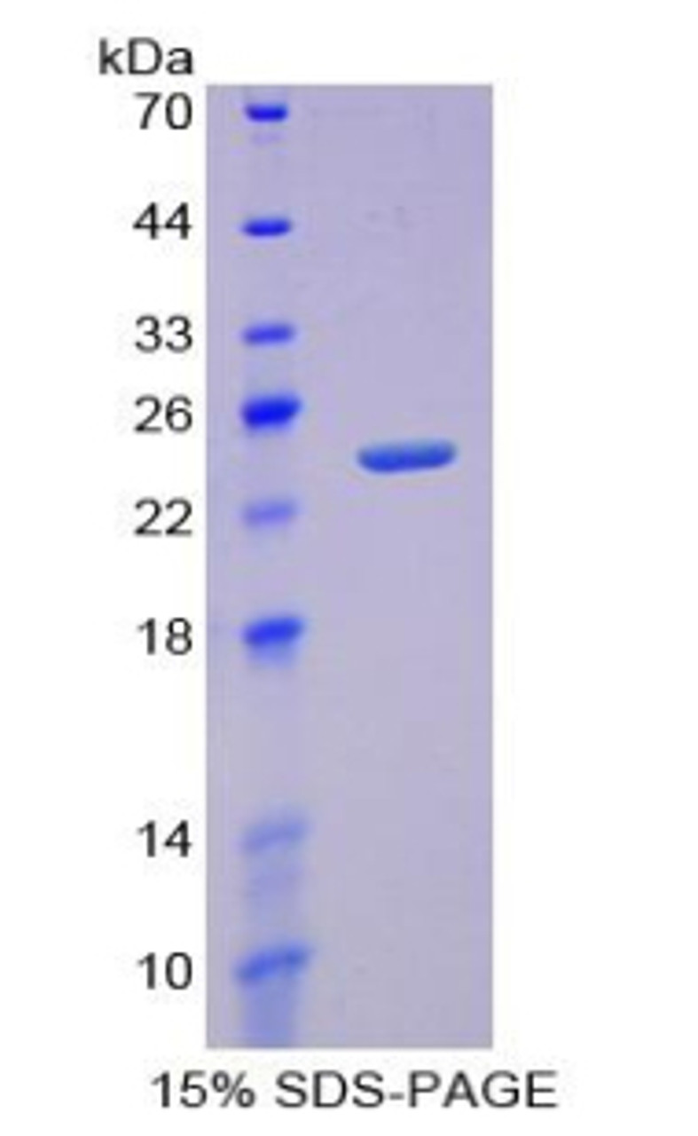 Rat Recombinant Receptor Activator Of Nuclear Factor Kappa B (RANk)