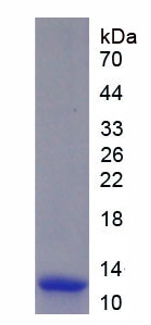 Human Recombinant Interferon Inducible T-Cell Alpha Chemoattractant (ITaC)