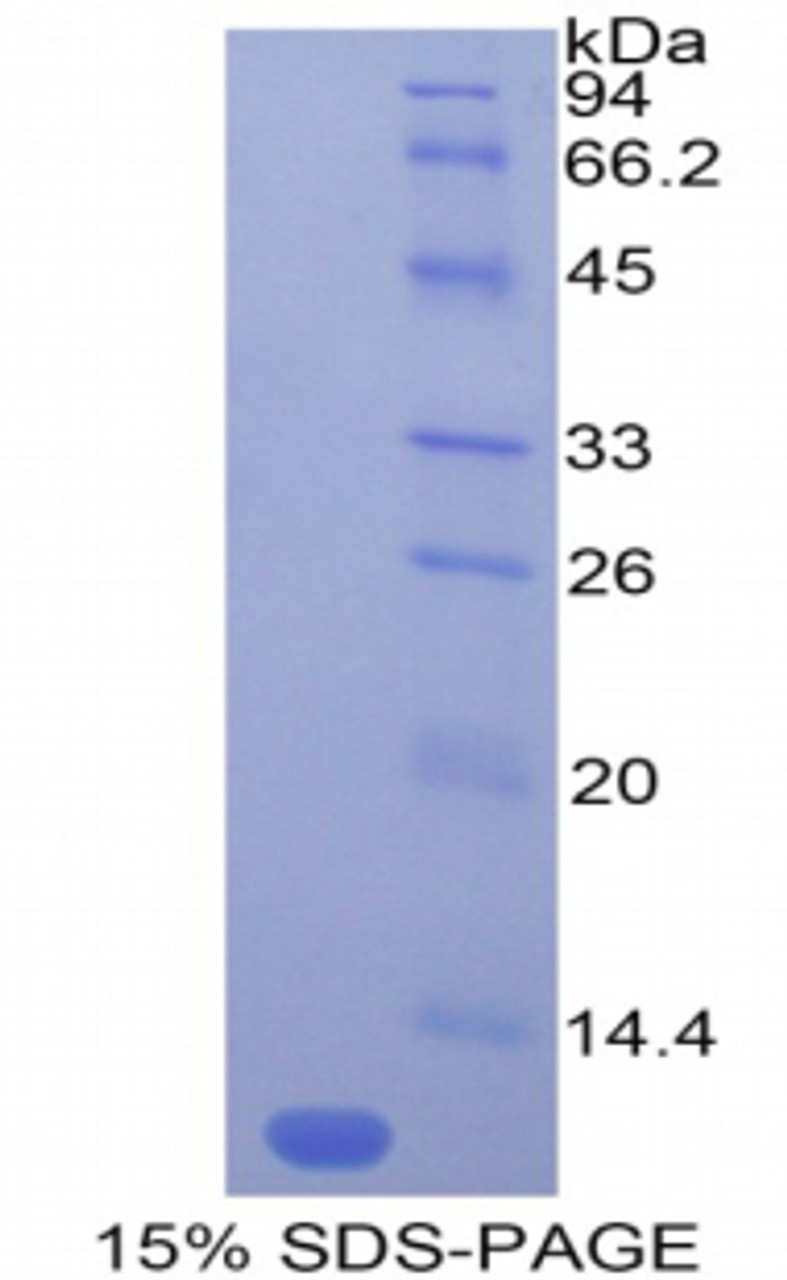 Mouse Recombinant Monocyte Chemotactic Protein 5 (MCP5)