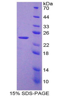 Rat Recombinant Laminin Beta 2 (LAMb2)